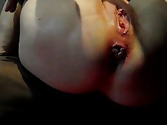 careful prolapsette away from anal grown-up